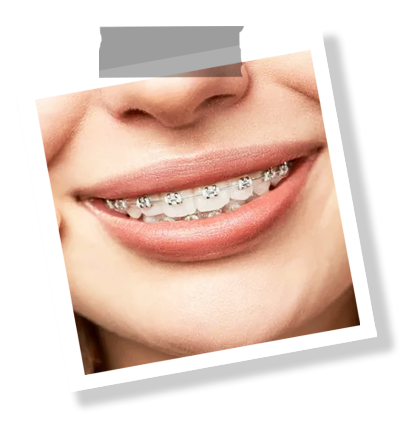 content-image